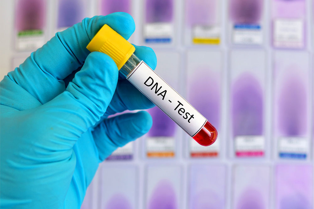 DNA Testing &#8211; Definition, Types, and Procedure