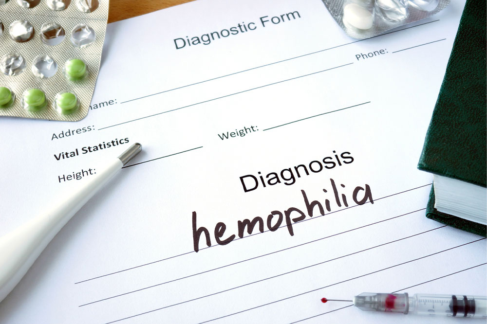 Hemophilia &#8211; Symptoms, Types, and Management Options