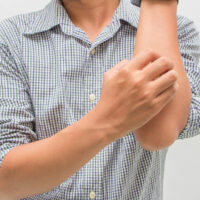 Jock Itch Disease &#8211; Its Symptoms, Causes, and Diagnoses