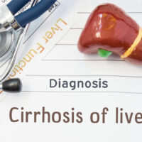 Liver Cirrhosis &#8211; Its Stages and Prevention