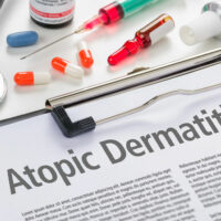 Measures to Manage and Prevent Atopic Dermatitis