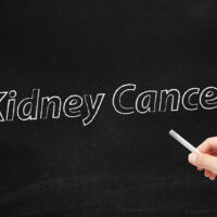 The Symptoms and Stages of Kidney Cancer