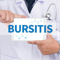 Types and Management Methods of Bursitis