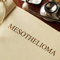 4 different types of mesothelioma you should be familiar with