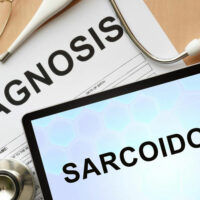 5 tell-tale signs and symptoms of sarcoidosis