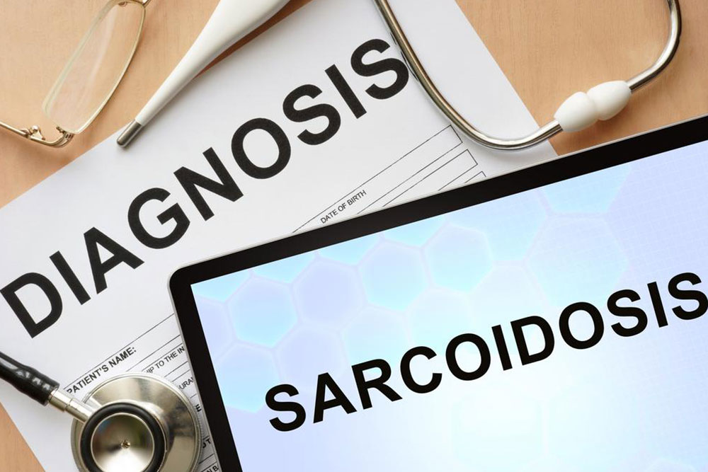 5 tell-tale signs and symptoms of sarcoidosis