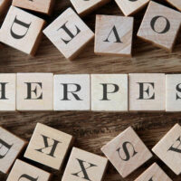 An overview of herpes