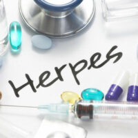 Causes and clinical symptoms of herpes