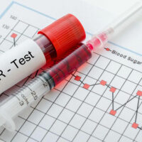 Everything you need to know about blood sugar and its levels