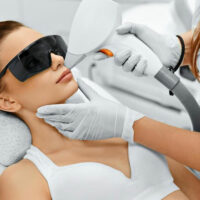 Laser hair removal &#8211; What to expect