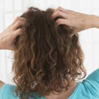 Symptoms and treatment of scalp psoriasis