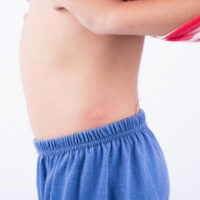 Ten types of skin rashes you should know about