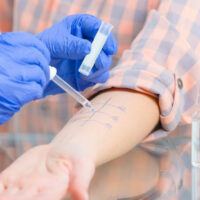 Why are A1C tests important for diabetes treatment?