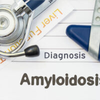 5 natural treatment options for amyloidosis