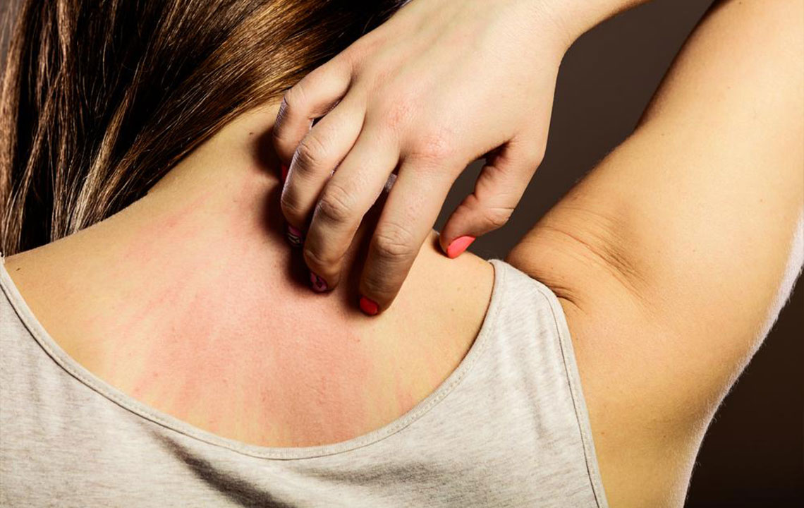 6 Natural Ways for Instant Relief from Itchy Skin