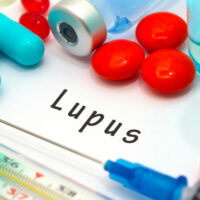 7 common symptoms of lupus