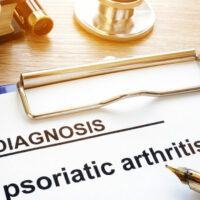 A guide to the symptoms of psoriatic arthritis