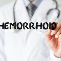 An Overview Of External Hemorrhoids- Causes, Symptoms, And Treatment