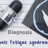 Causes, Symptoms, and Treatments for Chronic Fatigue Syndrome