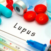 Causes and Symptoms of Lupus