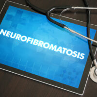 Doctor-recommended treatments for neurofibromatosis