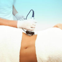 Effective Treatment Options for Cellulite