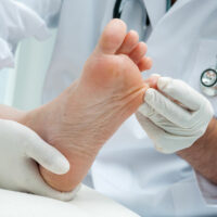 Effective Treatments for Toenail Fungus