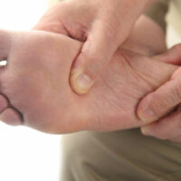 Everything You Need to Know about Plantar Fasciitis