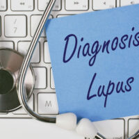 First Symptoms of Lupus to Watch Out For