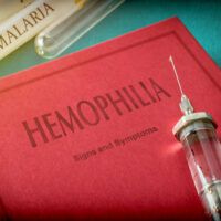 Hemophilia &#8211; 4 main symptoms and their severity