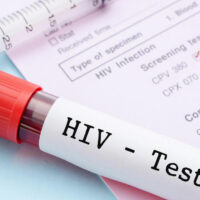 Know More About The Testing Of HIV