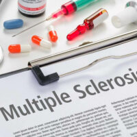 Most Promising New Multiple Sclerosis Treatment Options