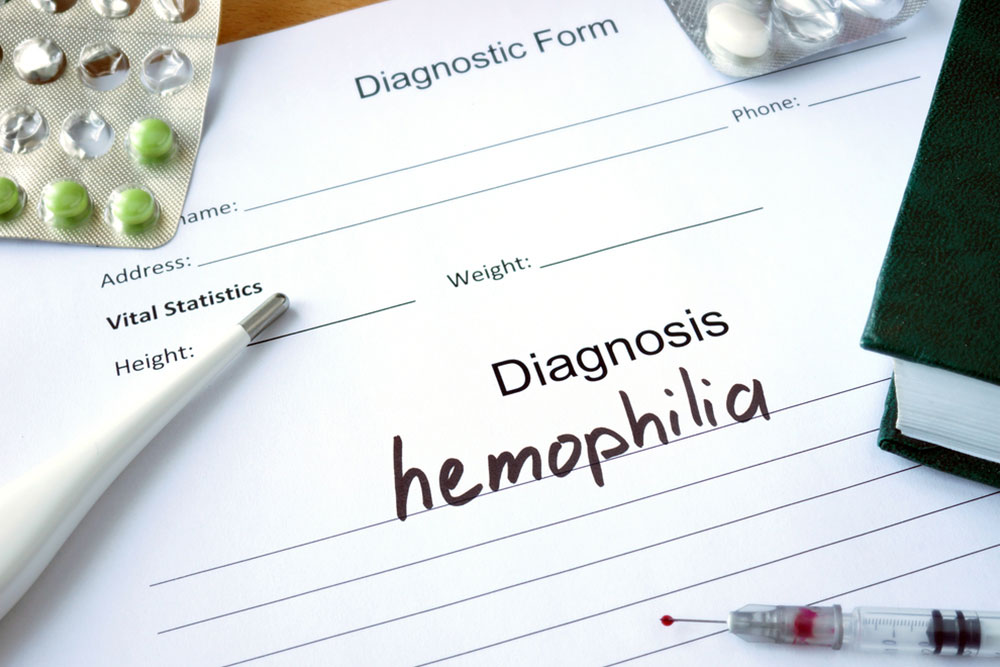 Must Know Facts About Hemophilia