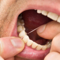 Removing Dental Plaque At Home