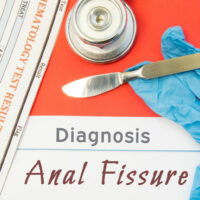 Anal Fissures &#8211; Its Causes, Symptoms, and Management